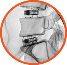 TiHawk Fluoroscopy